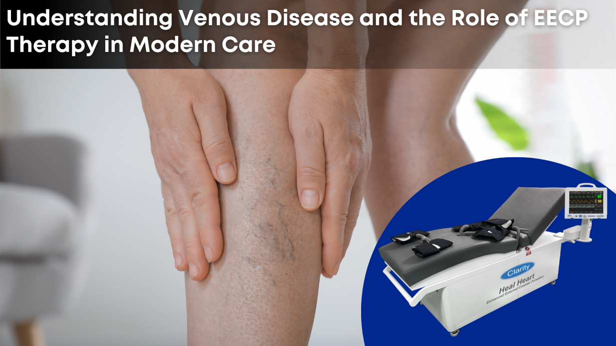 Understanding Venous Disease and the Role of EECP Therapy in Modern Care