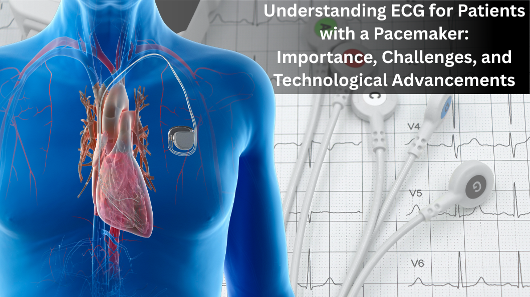 Understanding ECG for Patients with a Pacemaker: Importance, Challenges, and Technological Advancements