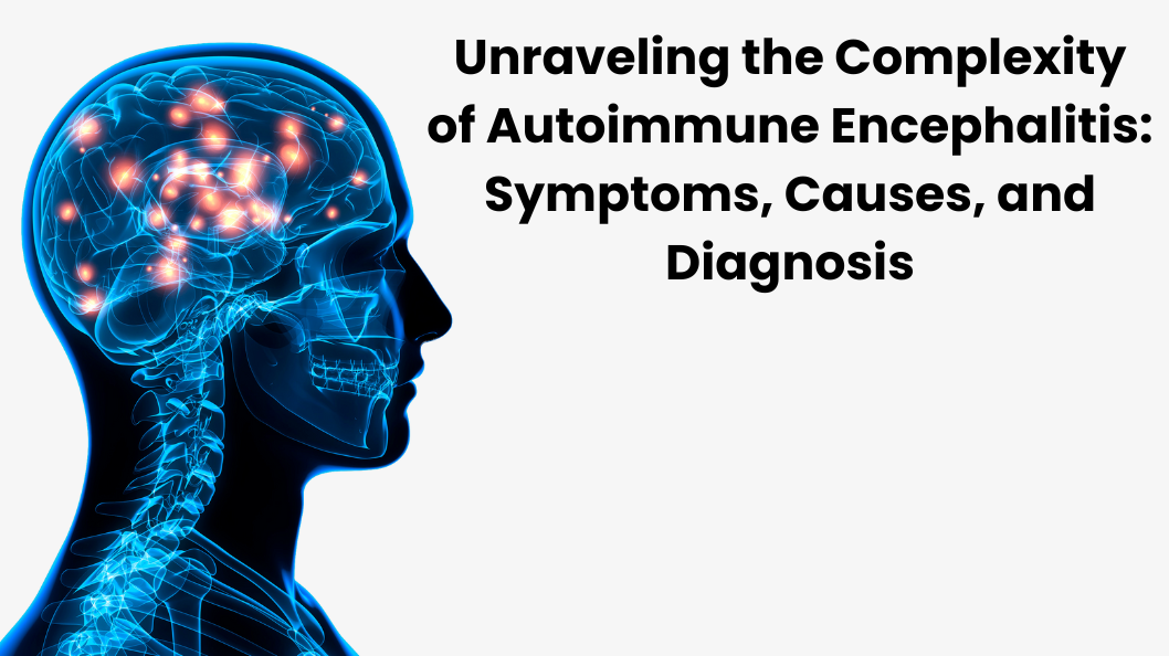 Unraveling the Complexity of Autoimmune Encephalitis: Symptoms, Causes, and Diagnosis