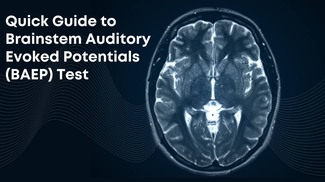 Quick Guide to Brainstem Auditory Evoked Potentials (BAEP) Test
