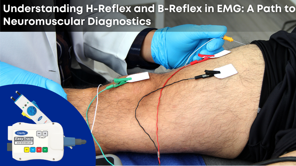 Understanding H-Reflex and B-Reflex in EMG: A Path to Neuromuscular Diagnostics