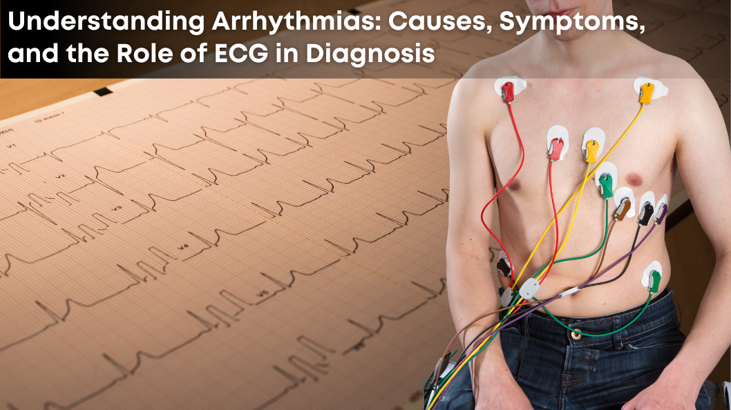 Understanding Arrhythmias: Causes, Symptoms, and the Role of ECG in Diagnosis