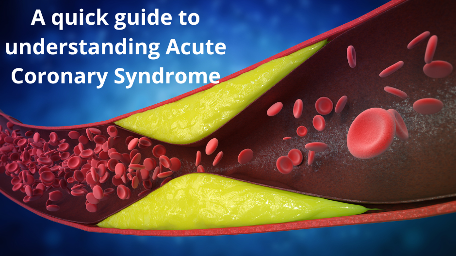 A quick guide to understanding Acute Coronary Syndrome