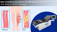 Quick Guide to Brainstem Auditory Evoked Potentials (BAEP) Test ...