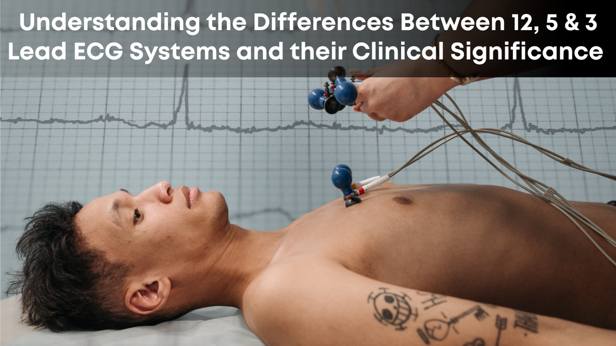 Understanding the Differences Between 12, 5 & 3 Lead ECG Systems and their Clinical Significance