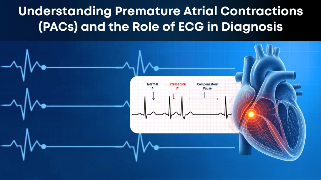 Understanding Premature Atrial Contractions (PACs) and the Role of ECG in Diagnosis