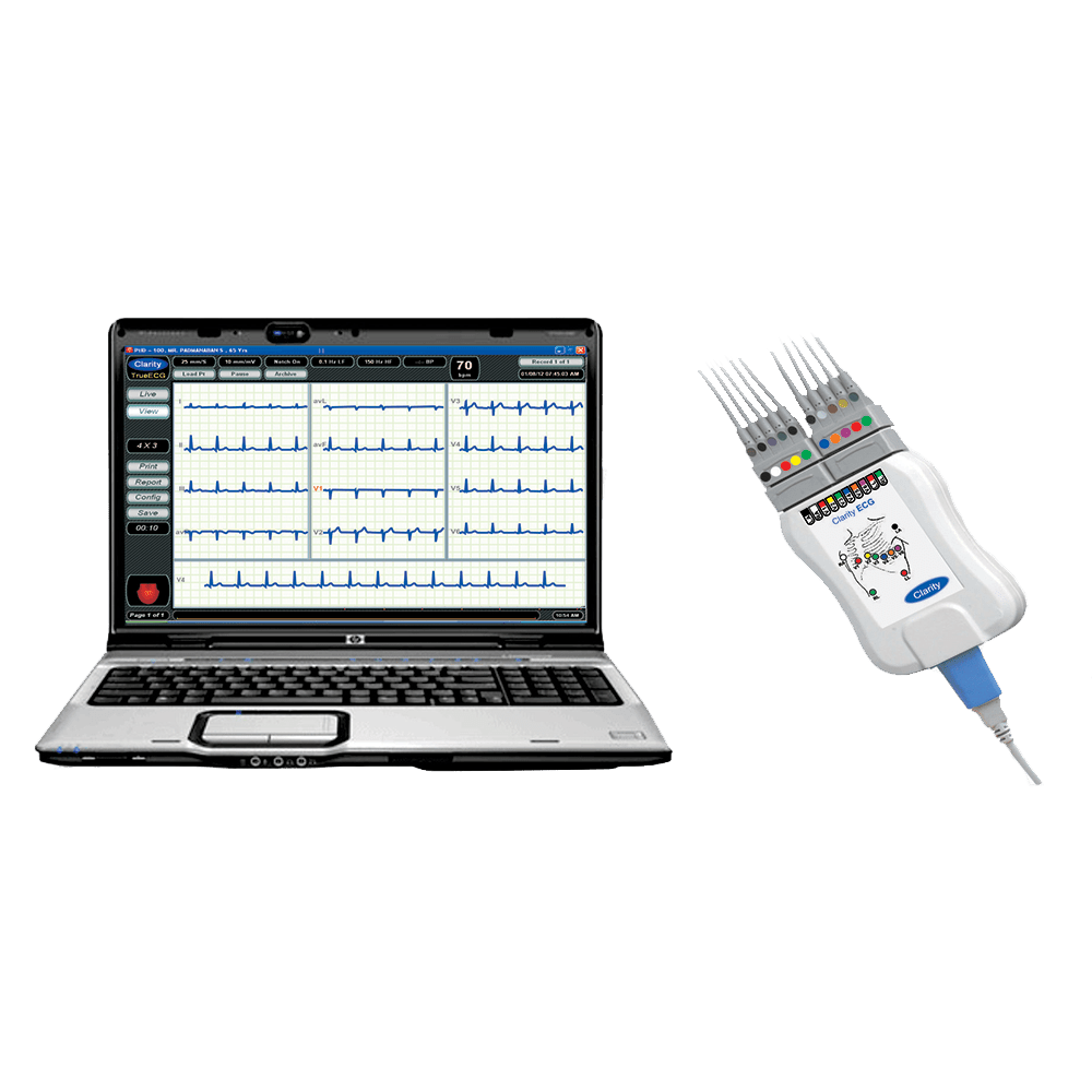 ECG machine - Clarity ECG